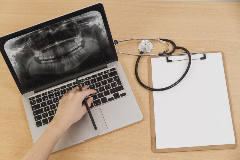 Radiografia panoramica dentale esaminata al computer durante la valutazione del caso